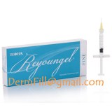 Reyoungel Fine Hyaluronidase hyaluronic acid serum Reyoungel Injection reyoungel filler