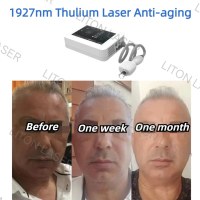 Laser Thulium de puissance 15W, équipement 1927 + 1550nm