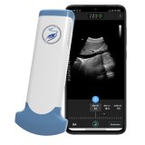 Classification of the Medical USG Transducer