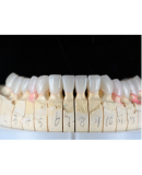 Layered Zirconia (Cut-back)