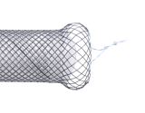 Anti-Reflux Esophageal Stents