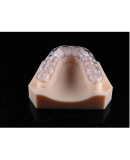 Occlusal Splint (Hard)-3D Print