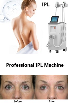 What to expect from your IPL treatment session