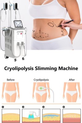 What can you expect from a cryolipolysis session?