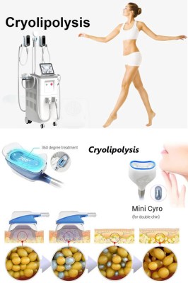 What makes cryolipolysis more attractive than liposuction?