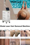 What to expect during diode laser hair removal