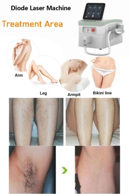 Pre care & after care--Diode Laser Hair Removal Machine