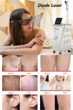 10 Benefits of Diode Laser Hair Removal