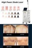 Permanent Solution to Your Unwanted Hair: Diode Laser Technology