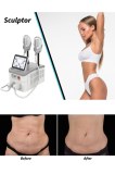 The ultimate guide to slim beauty machine Emsculpt treatment