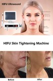 HIFU skin tightening facial treatment: all you need to know