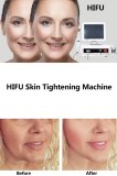 HIFU: The Non-Invasive Treatment for Skin Rejuvenation