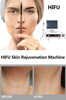 Pros and Cons of HIFU Facial Treatment