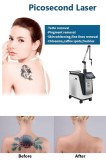 Remove unwanted tattoo with Picosecond Laser