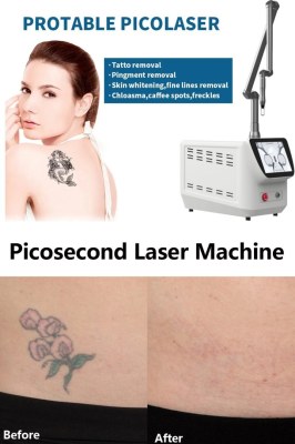 What makes Picosecond Laser so unique?