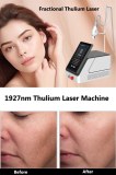 Skin Rejuvenation With Fractional Thulium Laser